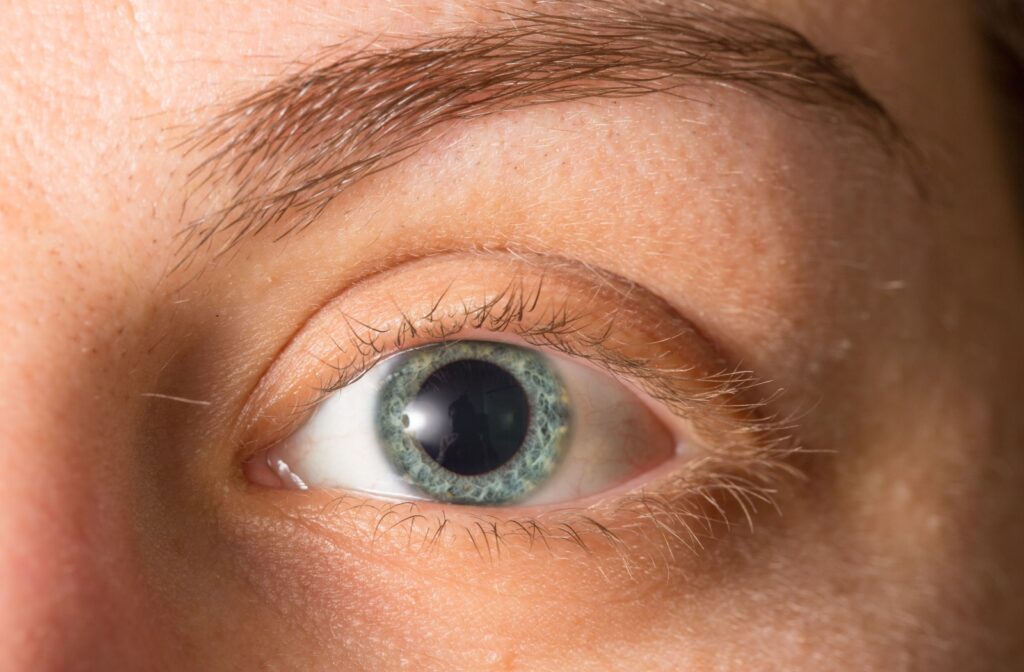 A close up of a dilated pupil